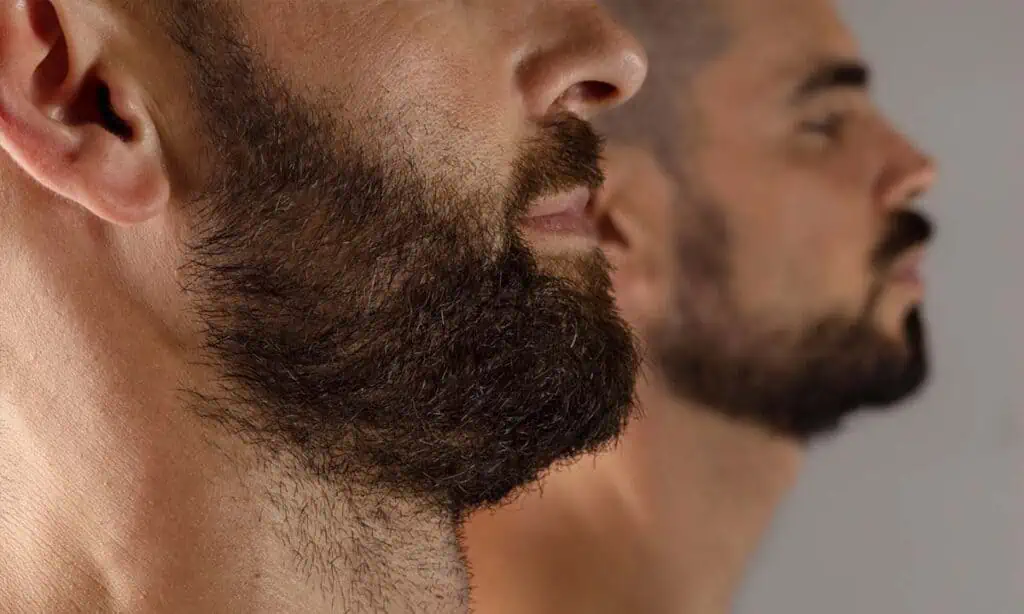 8 Cara Menumbuhkan Kumis dengan Cepat dan Lebat secara Alami. Mudah Dicoba! 6 cara menumbuhkan kumis dengan cepat dan lebat