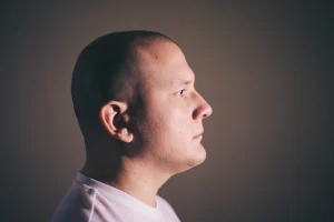 Rambut Rontok Ketika Menua, Ini Alasan dan Tips Mengatasinya!