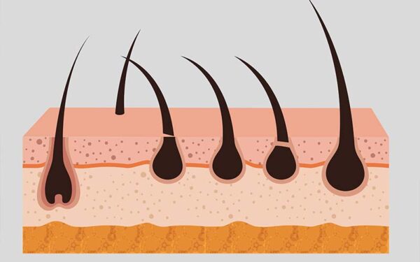 Fungsi Akar Rambut pada Kulit Manusia yang Sangat Penting